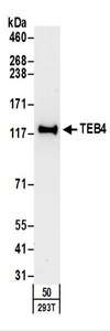 Detection of Human TEB4 by Western Blot. Samples: Whole cell lysate (50 ug) from 293T cells. Antibodies: Affinity purified rabbit anti-TEB4 antibody used for WB at 1 ug/ml. Detection: Chemiluminescence with an exposure time of 30 seconds.