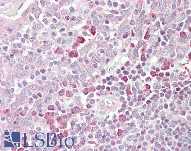 Anti-MARCH6 antibody IHC of human tonsil. Immunohistochemistry of formalin-fixed, paraffin-embedded tissue after heat-induced antigen retrieval. Antibody LS-B7361 concentration 3.75 ug/ml.