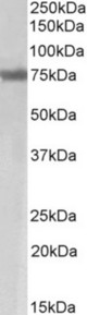 MARCH7 antibody ((2 ug/ml) staining of Mouse Skeletal Muscle lysate (35 ug protein in RIPA buffer). Primary incubation was 1 hour. Detected by chemiluminescence.