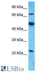 MARCH7 / Axotrophin antibody Western Blot of Uterus Tumor. Antibody dilution: 1 ug/ml.