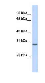 MARCH8 antibody LS-C110784 Western blot of Fetal Muscle lysate.