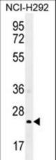 GSTA3 Antibody western blot of NCI-H292 cell line lysates (35 ug/lane). The GSTA3 antibody detected the GSTA3 protein (arrow).