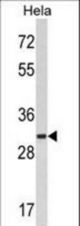 Western blot of hMARCKS-K254 in HeLa cell line lysates (35 ug/lane). MARCKS (arrow) was detected using the purified antibody.