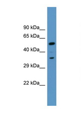 MARCKS antibody LS-C135769 Western blot of Fetal Liver lysate. Antibody concentration 1 ug/ml.
