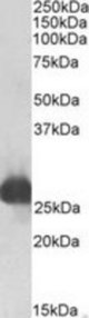 GSTA3 antibody (0.1 ug/ml) staining of Rat Liver lysate (35 ug protein/ml in RIPA buffer). Primary incubation was 1 hour. Detected by chemiluminescence.
