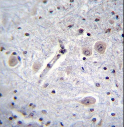 MARK Antibody immunohistochemistry of formalin-fixed and paraffin-embedded human brain tissue followed by peroxidase-conjugated secondary antibody and DAB staining.
