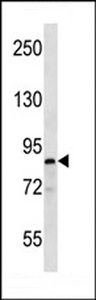 MARK Antibody (S658) western blot of T47D cell line lysates (35 ug/lane). The MARK antibody detected the MARK protein (arrow).