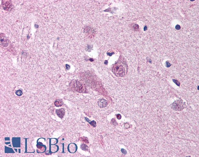 Anti-MARK1 antibody LS-A9499 IHC of human brain, cortex. Immunohistochemistry of formalin-fixed, paraffin-embedded tissue after heat-induced antigen retrieval.