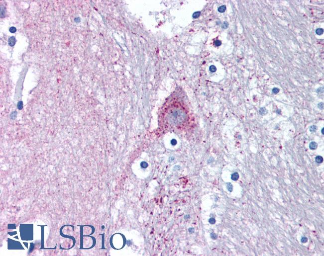 Anti-MARK1 antibody LS-A9497 IHC of human brain, caduate. Immunohistochemistry of formalin-fixed, paraffin-embedded tissue after heat-induced antigen retrieval.
