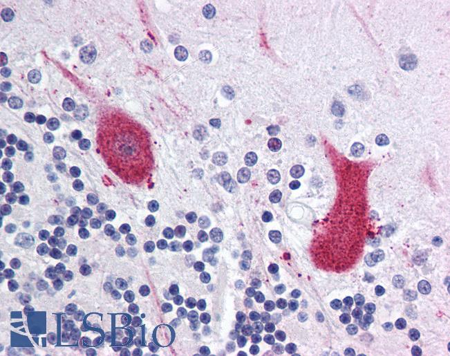 Anti-MARK1 antibody LS-A9500 IHC of human brain, cerebellum. Immunohistochemistry of formalin-fixed, paraffin-embedded tissue after heat-induced antigen retrieval.