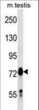 Mouse Mark4 Antibody western blot of mouse testis tissue lysates (35 ug/lane). The Mark4 antibody detected the Mark4 protein (arrow).