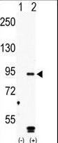 Western blot of MARK4 (arrow) using rabbit polyclonal hMARK4-R626 Antibody. 293 cell lysates (2 ug/lane) either nontransfected (Lane 1) or transiently transfected with the MARK4 gene (Lane 2) (Origene Technologies).