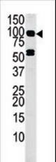 Western blot of anti-MARK4 antibody in mouse liver tissue lysate (35 ug/lane). MARK4(arrow) was detected using the purified antibody.