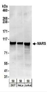 Detection of Human MARS by Western Blot. Samples: Whole cell lysate (50 ug) from 293T, HeLa, and Jurkat cells. Antibodies: Affinity purified rabbit anti-MARS antibody used for WB at 0.1 ug/ml. Detection: Chemiluminescence with an exposure time of 30 seconds.