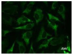 Immunofluorescent staining using MARS antibody. Immunostaining analysis in HeLa cells. HeLa cells were fixed with 4% paraformaldehyde and permeabilized with 0.01% Triton-X100 in PBS. The cells were immunostained with anti-MARS antibody.