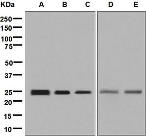 Western blot analysis on (A) fetal brain, (B) fetal liver, (C) 293T, (D) HepG2, and (E) JAR cell lysates using anti-GSTA4 antibody.