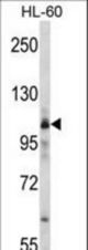 Western blot of MARS Antibody in HL-60 cell line lysates (35 ug/lane). cMARS (arrow) was detected using the purified antibody.