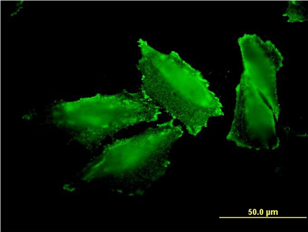 Immunofluorescence of monoclonal antibody to MARS on HepG2 cell. [antibody concentration 10 ug/ml]