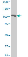 MARS monoclonal antibody (M01), clone 5G5 Western Blot analysis of MARS expression in HepG2.