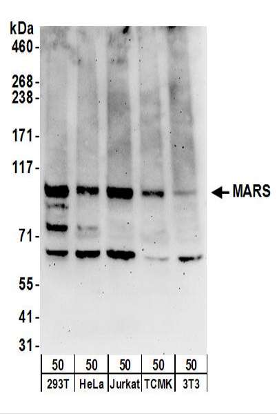 Detection of Human and Mouse MARS by Western Blot. Samples: Whole cell lysate (50 ug) from 293T, HeLa, Jurkat, mouse TCMK-1, and mouse NIH3T3 cells. Antibodies: Affinity purified rabbit anti-MARS antibody used for WB at 0.4 ug/ml. Detection: Chemiluminescence with an exposure time of 3 minutes.