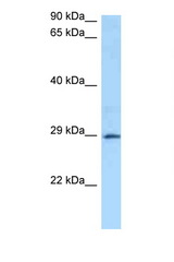 GSTA4 antibody LS-C146264 Western blot of 1 Cell lysate. Antibody concentration 1 ug/ml.