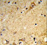 Formalin-fixed and paraffin-embedded human brain tissue reacted with MALD2 Antibody , which was peroxidase-conjugated to the secondary antibody, followed by DAB staining. This data demonstrates the use of this antibody for immunohistochemistry; clinical relevance has not been evaluated.