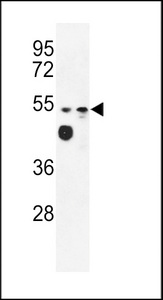 Western blot of MALD2 Antibody in WiDr, MDA-MB231 cell line lysates (35 ug/lane). MALD2 (arrow) was detected using the purified antibody.