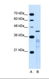 Lane A: Marker. Lane B: Jurkat cell lysate. Antibody concentration: 0.25 ug/ml. Gel concentration: 12%.
