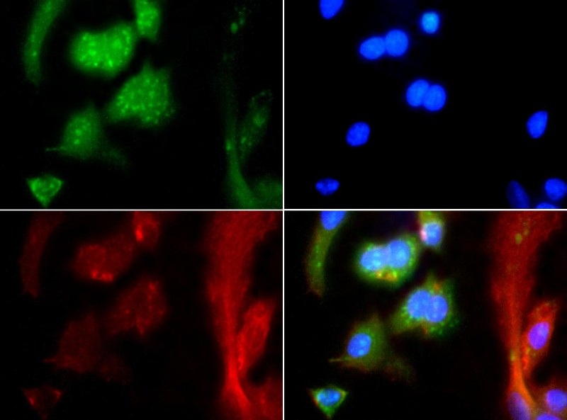 Immunocytochemistry/Immunofluorescence: MAS1 Antibody - MAS1 antibody was tested at 1:25 in HepG2 cells with FITC (green). Nuclei were counterstained with Dapi (blue).
