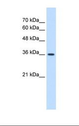 HepG2 cell lysate. Antibody concentration: 1.25 ug/ml. Gel concentration: 12%.