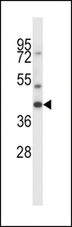 MAS1 Antibody western blot of CEM cell line lysates (35 ug/lane). The MAS1 antibody detected the MAS1 protein (arrow).