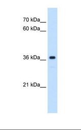 HepG2 cell lysate. Antibody concentration: 0.25 ug/ml. Gel concentration: 12%.