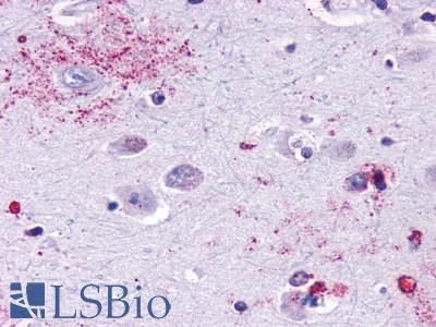 Anti-MAS1 antibody LS-A1531 IHC of human brain, neurons and glia. Immunohistochemistry of formalin-fixed, paraffin-embedded tissue after heat-induced antigen retrieval.