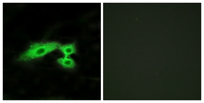 Immunofluorescence of HeLa cells, using MAS1L Antibody. The picture on the right is treated with the synthesized peptide.