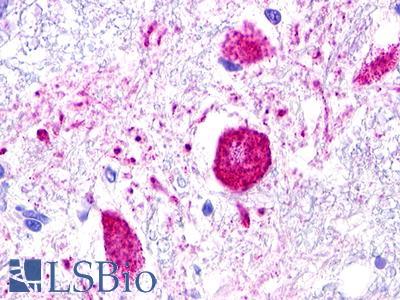 Anti-MAS1L / MRG antibody IHC of human brain, medulla, neurons. Immunohistochemistry of formalin-fixed, paraffin-embedded tissue after heat-induced antigen retrieval. Antibody LS-A187 dilution 2-3 ug/ml.
