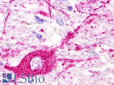Anti-MAS1L / MRG antibody IHC of human brain, hypothalamus, neurons. Immunohistochemistry of formalin-fixed, paraffin-embedded tissue after heat-induced antigen retrieval. Antibody LS-A187 dilution 2-3 ug/ml.