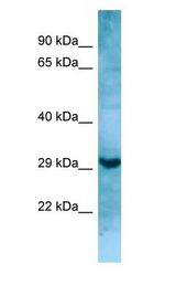 MASP1 / MASP antibody Western Blot of HT1080.