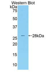 Western blot of recombinant MASP2 / MASP-2.