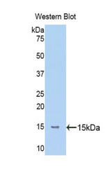 Western blot of recombinant MASP2 / MASP-2.