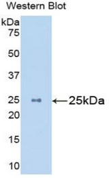 Western blot of recombinant MASP2 / MASP-2.