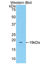 Western blot of recombinant MASP2 / MASP-2.