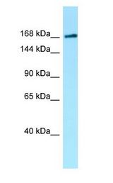 MAST1 antibody Western Blot of HT1080.