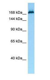 MAST1 antibody Western Blot of Jurkat.
