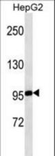 MASTL western blot of HepG2 cell line lysates (35 ug/lane). The MASTL antibody detected the MASTL protein (arrow).