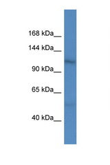 MASTL antibody LS-C135854 Western blot of Fetal Heart lysate. Antibody concentration 1 ug/ml.