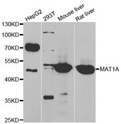 Western blot analysis of extracts of various cell lines, using MAT1A antibody.
