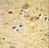 Formalin-fixed and paraffin-embedded human brain tissue reacted with GSTA4 Antibody , which was peroxidase-conjugated to the secondary antibody, followed by DAB staining. This data demonstrates the use of this antibody for immunohistochemistry; clinical relevance has not been evaluated.
