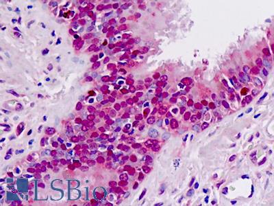 Anti-MAT / MAT1A antibody IHC staining of human lung. Immunohistochemistry of formalin-fixed, paraffin-embedded tissue after heat-induced antigen retrieval.