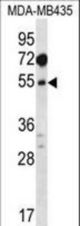 MAT1A Antibody western blot of MDA-MB435 cell line lysates (35 ug/lane). The MAT1A antibody detected the MAT1A protein (arrow).