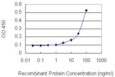 Detection limit for recombinant GST tagged MAT1A is 1 ng/ml as a capture antibody.